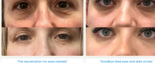 Glokore EyeRenew Pro benefits
