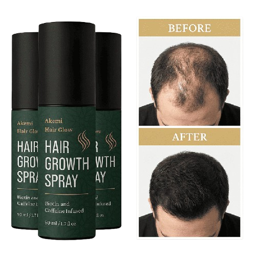 Akemi Hair Glow Benefits